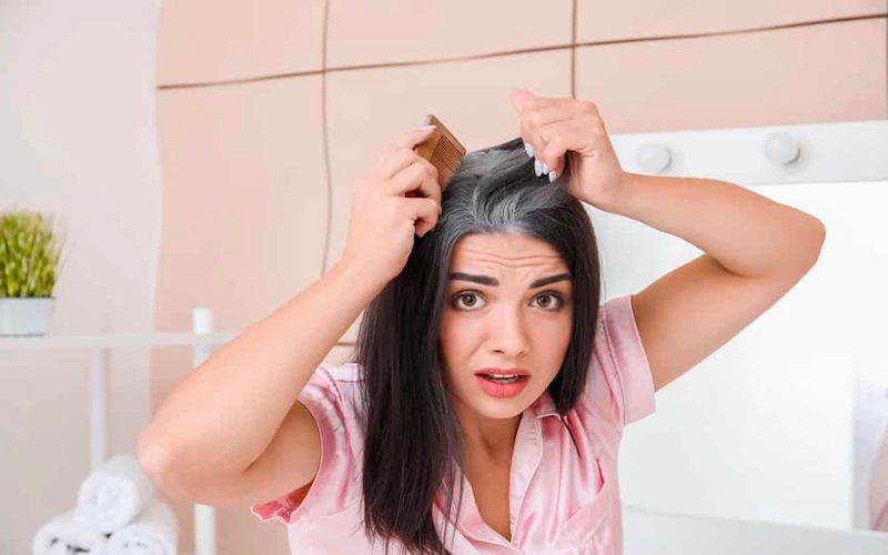 cách trị tóc bạc sớm cach-tri-toc-bac-som