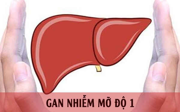 Gan nhiễm mỡ độ 1 Nguyên nhân, triệu chứng và cách điều trị hiệu quả