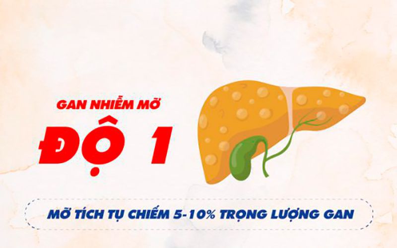 gan nhiễm mỡ độ 1