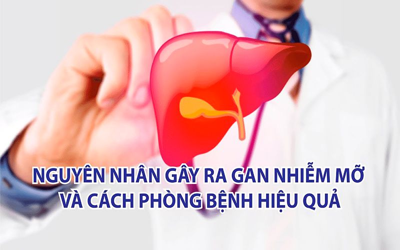 4 Nguyên nhân gan nhiễm mỡ tiềm ẩn 27 nguyen-nhan-gan-nhiem-mo