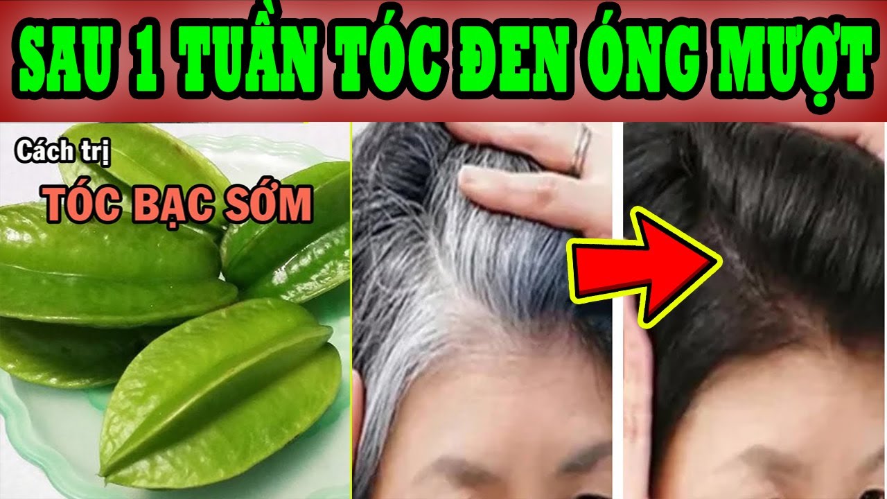 Nguyên nhân tóc bạc sớm ở nữ giới