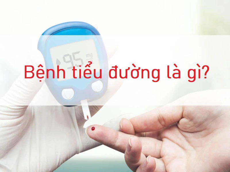 Bệnh tiểu đường là gì Định nghĩa, nguyên nhân, triệu chứng, biến chứng, phòng ngừa và điều trị 6 Bệnh tiểu đường là gì Định nghĩa, nguyên nhân, triệu chứng, biến chứng, phòng ngừa và điều trị