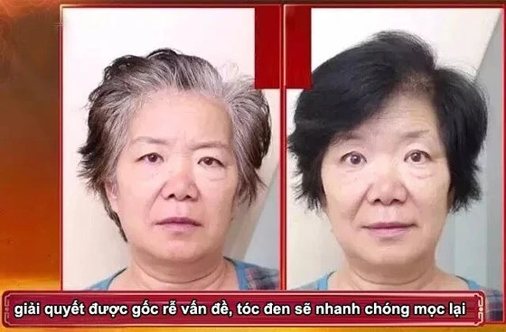 hanh trinh lay lai mai toc den ong muot 66ed85709ab06